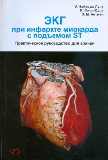 Байдес, Фиол-Сала, Антман - ЭКГ при инфаркте миокарда с подъемом ST обложка книги Байдес, Фиол-Сала, Антман - ЭКГ при инфаркте миокарда с подъемом ST обложка книги