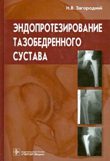Николай Загородний - Эндопротезирование тазобедренного сустава. Основы и практика. Руководство обложка книги Николай Загородний - Эндопротезирование тазобедренного сустава. Основы и практика. Руководство обложка книги