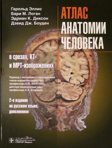 Эллис, Логан, Диксон - Атлас анатомии человека в срезах, КТ- и МРТ-изображениях обложка книги