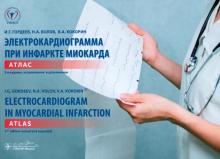 Гордеев, Волов, Кокорин - Электрокардиограмма при инфаркте миокарда. Атлас на русском и английском языках обложка книги Гордеев, Волов, Кокорин - Электрокардиограмма при инфаркте миокарда. Атлас на русском и английском языках обложка книги
