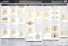 Плакат "Техника наложения швов" в тубусе
